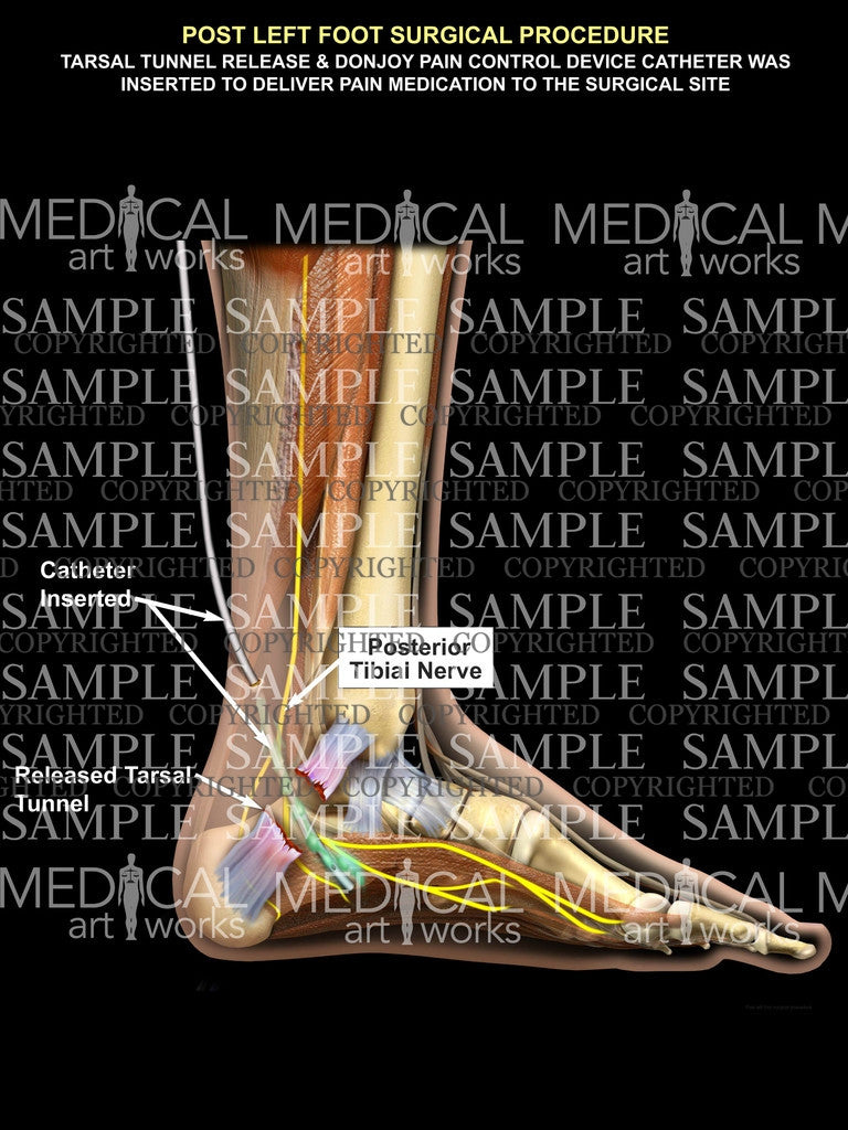 Nerve anatomy lower leg – Medical Art Works