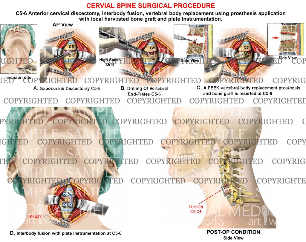 Anterior Cervical Region